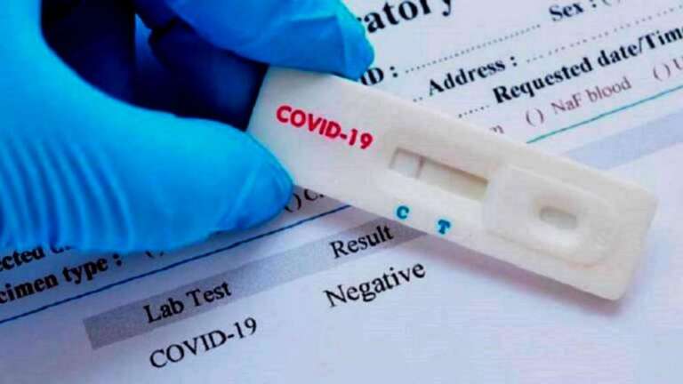 Sindicatos rurais de SP recebem testes rápidos de COVID-19