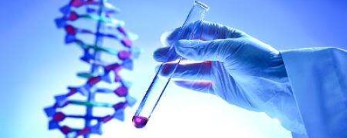 PCR